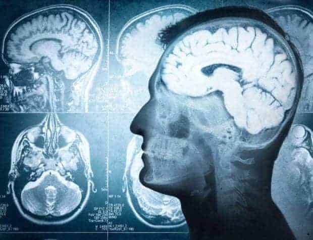 Scientists say they've identified area of the brain associated with alcohol addiction.
